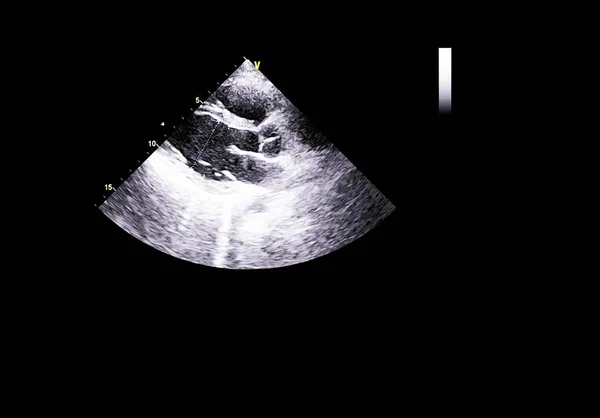 Scherm van echocardiografie (echografie) machine. — Stockfoto