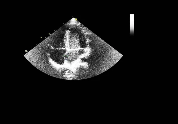 Pantalla de la máquina de ecocardiografía (ultrasonido) . — Foto de Stock