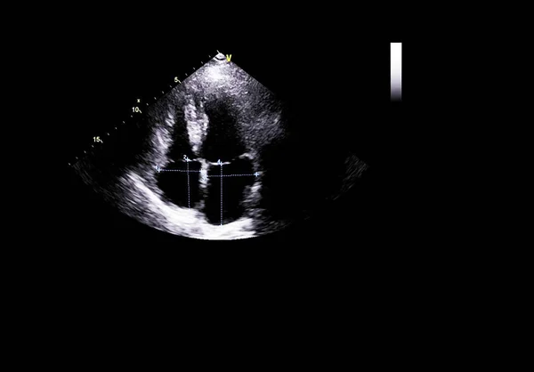 Bildschirm der Echokardiographie (Ultraschall) Maschine. — Stockfoto