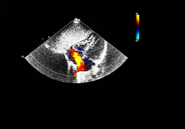 Οθόνη ηχοκαρδιογραφίας (υπερήχων) μηχανή. — Φωτογραφία Αρχείου