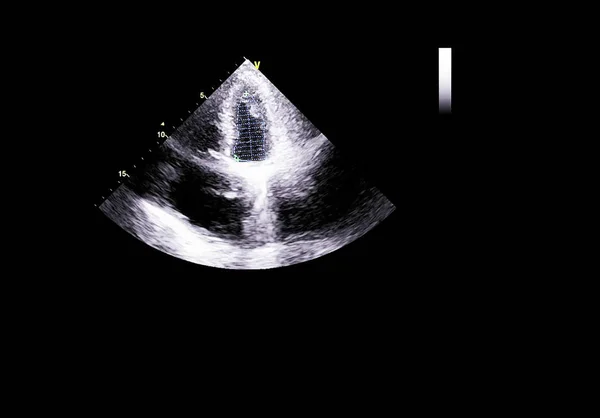 Tela da máquina de ecocardiografia (ultra-som) . — Fotografia de Stock