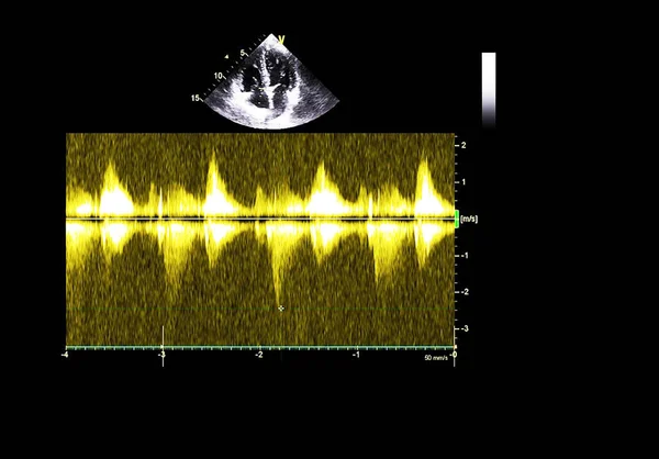 Οθόνη ηχοκαρδιογραφίας (υπερήχων) μηχανή. — Φωτογραφία Αρχείου