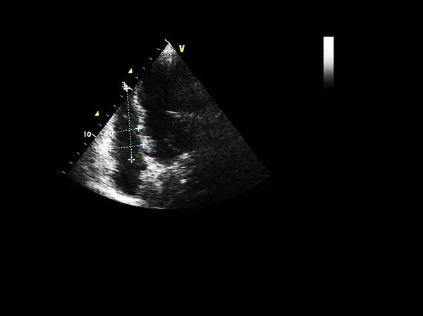 Tela da máquina de ecocardiografia (ultra-som) . — Fotografia de Stock