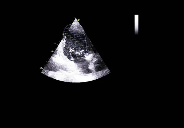 Tela da máquina de ecocardiografia (ultra-som) . — Fotografia de Stock