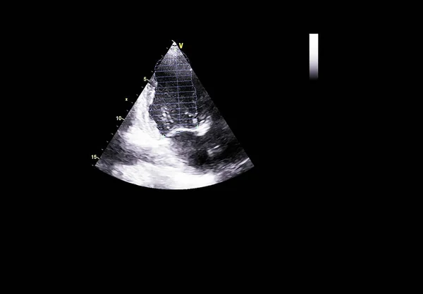 Tela da máquina de ecocardiografia (ultra-som) . — Fotografia de Stock