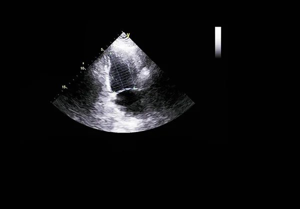 Écran de la machine d'échocardiographie (échographie) . — Photo