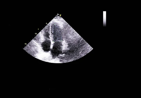 Pantalla de la máquina de ecocardiografía (ultrasonido) . — Foto de Stock