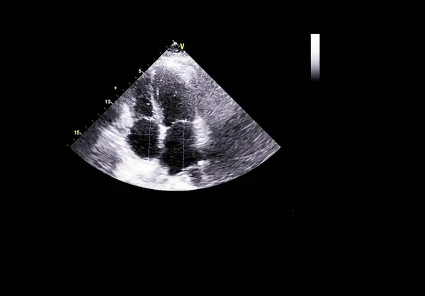 Scherm van echocardiografie (echografie) machine. — Stockfoto