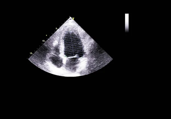 Écran de la machine d'échocardiographie (échographie) . — Photo