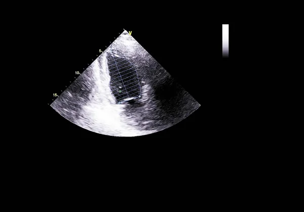 Tela da máquina de ecocardiografia (ultra-som) . — Fotografia de Stock