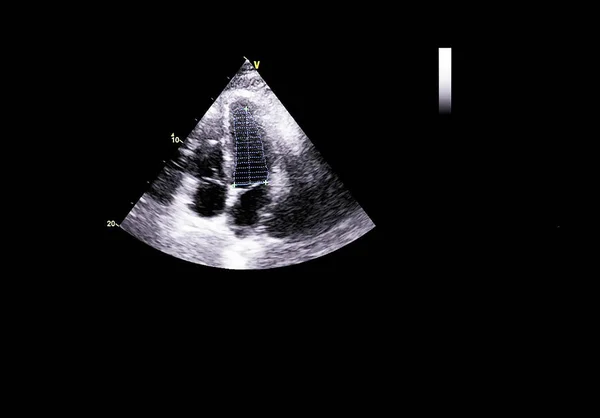 Képernyő echokardiográfia (ultrahang) gép. — Stock Fotó