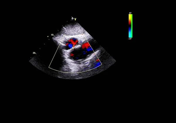 Tela da máquina de ecocardiografia (ultra-som) . — Fotografia de Stock