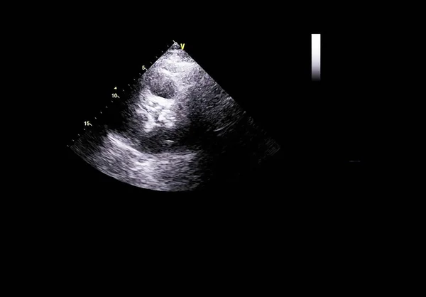 Mesin echocardiography (ultrasound) layar . — Stok Foto