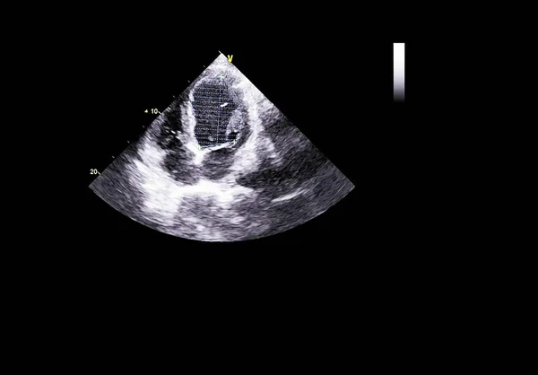 Pantalla de la máquina de ecocardiografía (ultrasonido) . —  Fotos de Stock