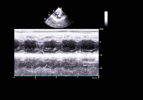 Scherm van echocardiografie (echografie) machine. — Stockfoto