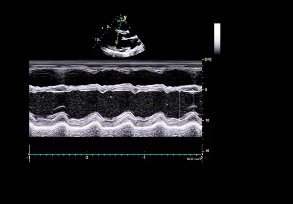 Bildschirm der Echokardiographie (Ultraschall) Maschine. — Stockfoto