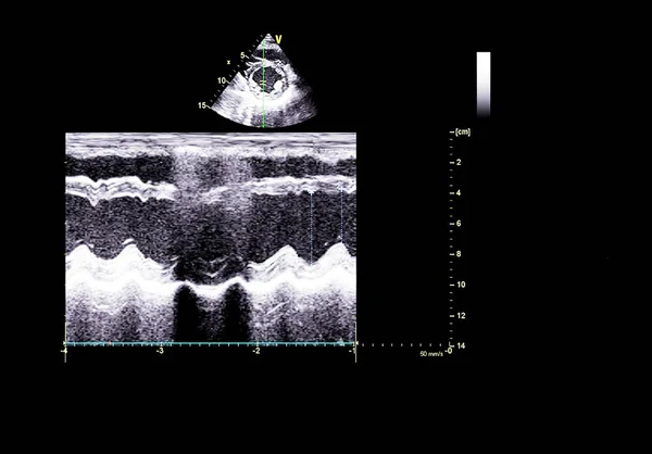 Οθόνη ηχοκαρδιογραφίας (υπερήχων) μηχανή. — Φωτογραφία Αρχείου