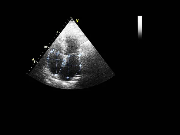 Tela da máquina de ecocardiografia (ultra-som) . — Fotografia de Stock