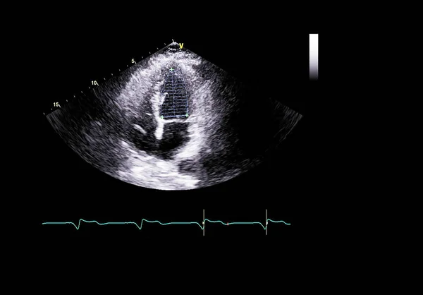 Ekran echokardiografii (USG) maszyny. — Zdjęcie stockowe