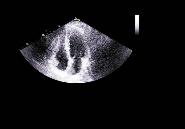 Tela da máquina de ecocardiografia (ultra-som) . — Fotografia de Stock