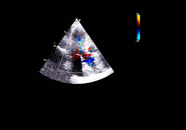 Pantalla de la máquina de ecocardiografía (ultrasonido) . — Foto de Stock