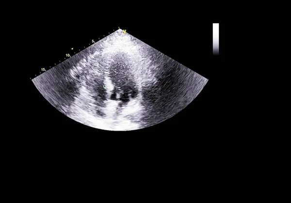 Bildschirm der Echokardiographie (Ultraschall) Maschine. — Stockfoto