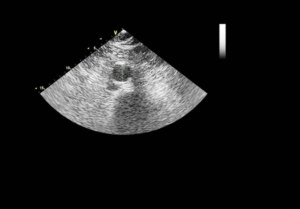 Tela da máquina de ecocardiografia (ultra-som) . — Fotografia de Stock