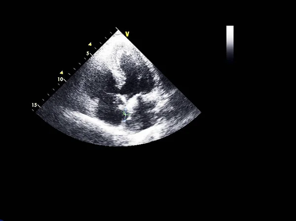 Pantalla de la máquina de ecocardiografía (ultrasonido) . — Foto de Stock