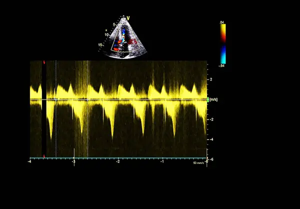Schermo della macchina ecografica (ultrasuoni) . — Foto Stock