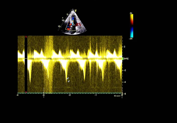 超声心动图（超声）机屏幕. — 图库照片