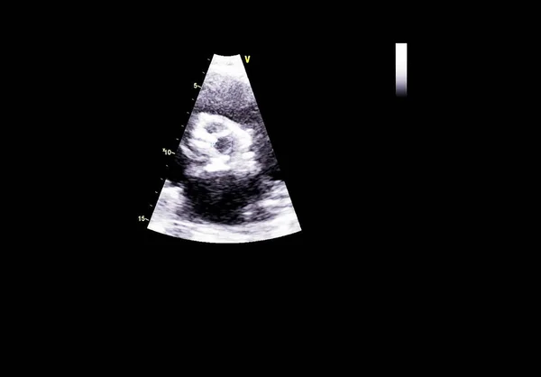 Pantalla de la máquina de ecocardiografía (ultrasonido) . —  Fotos de Stock