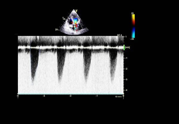 Tela da máquina de ecocardiografia (ultra-som) . — Fotografia de Stock