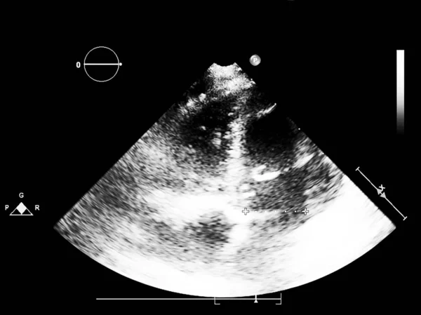 Écran de la machine d'échocardiographie (échographie) . — Photo