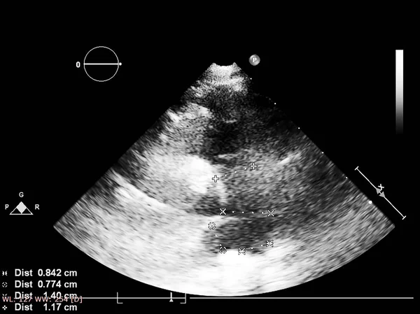 Écran de la machine d'échocardiographie (échographie) . — Photo