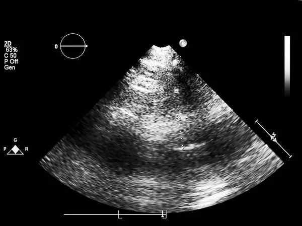 Écran de la machine d'échocardiographie (échographie) . — Photo