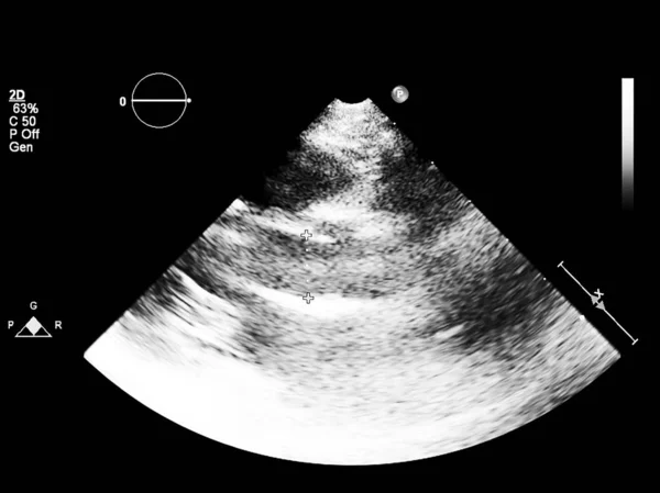 Écran de la machine d'échocardiographie (échographie) . — Photo