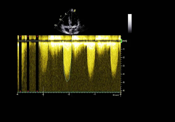 超声心动图（超声）机屏幕. — 图库照片