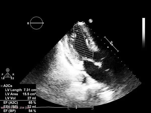 Écran de la machine d'échocardiographie (échographie) . — Photo