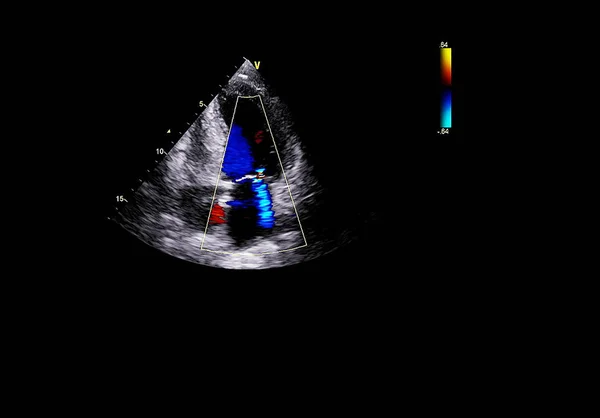 Pantalla de la máquina de ecocardiografía (ultrasonido) . — Foto de Stock