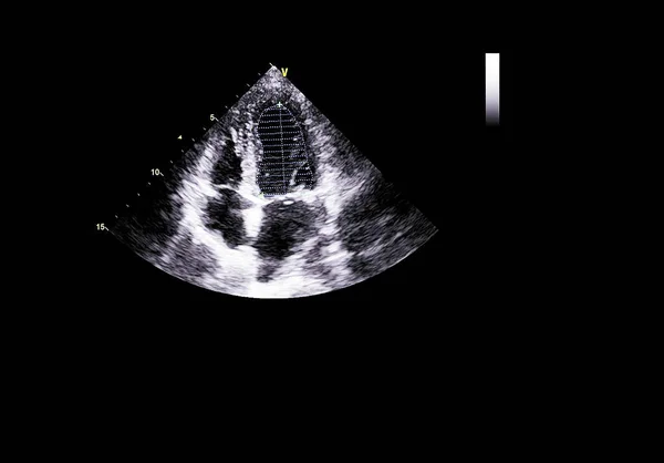 Tela da máquina de ecocardiografia (ultra-som) . — Fotografia de Stock