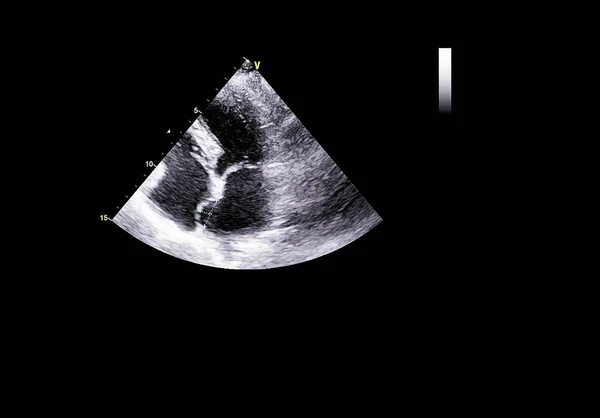 Screen of echocardiography (ultrasound) machine. — Stock Photo, Image