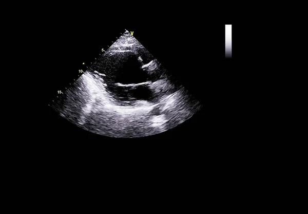 Tela da máquina de ecocardiografia (ultra-som) . — Fotografia de Stock