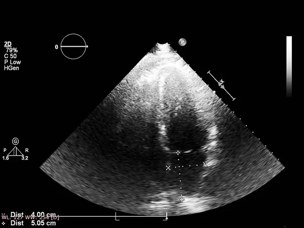 Skärm av ekokardiografi (ultraljud) maskin. — Stockfoto
