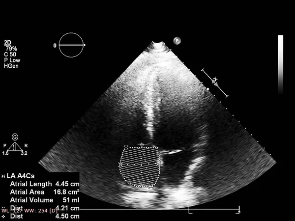 Bildschirm der Echokardiographie (Ultraschall) Maschine. — Stockfoto