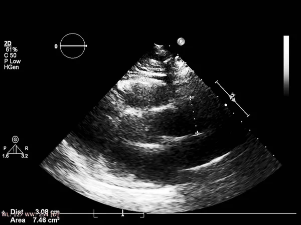 Tela da máquina de ecocardiografia (ultra-som) . — Fotografia de Stock