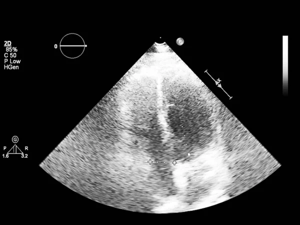 Pantalla de la máquina de ecocardiografía (ultrasonido) . —  Fotos de Stock