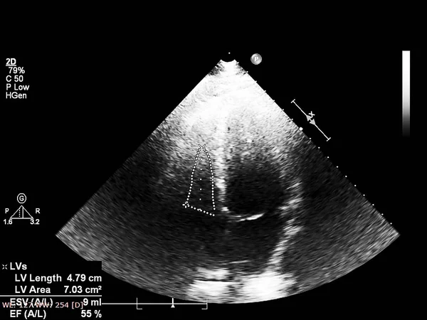 Skärm av ekokardiografi (ultraljud) maskin. — Stockfoto