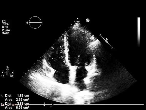 Écran de la machine d'échocardiographie (échographie) . — Photo