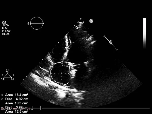 Écran de la machine d'échocardiographie (échographie) . — Photo