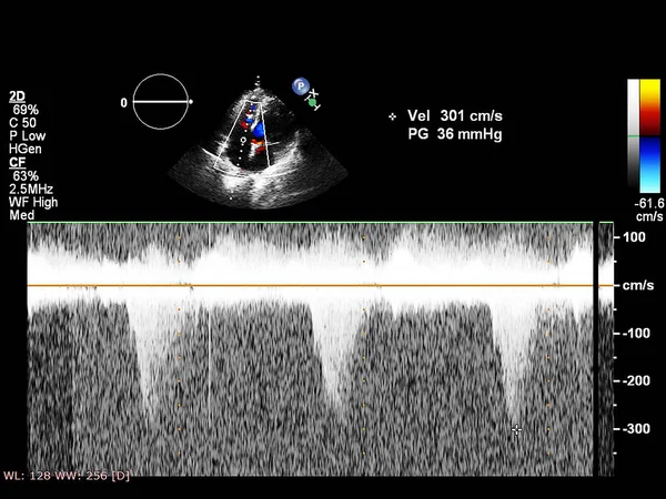 Pantalla de la máquina de ecocardiografía (ultrasonido) . — Foto de Stock